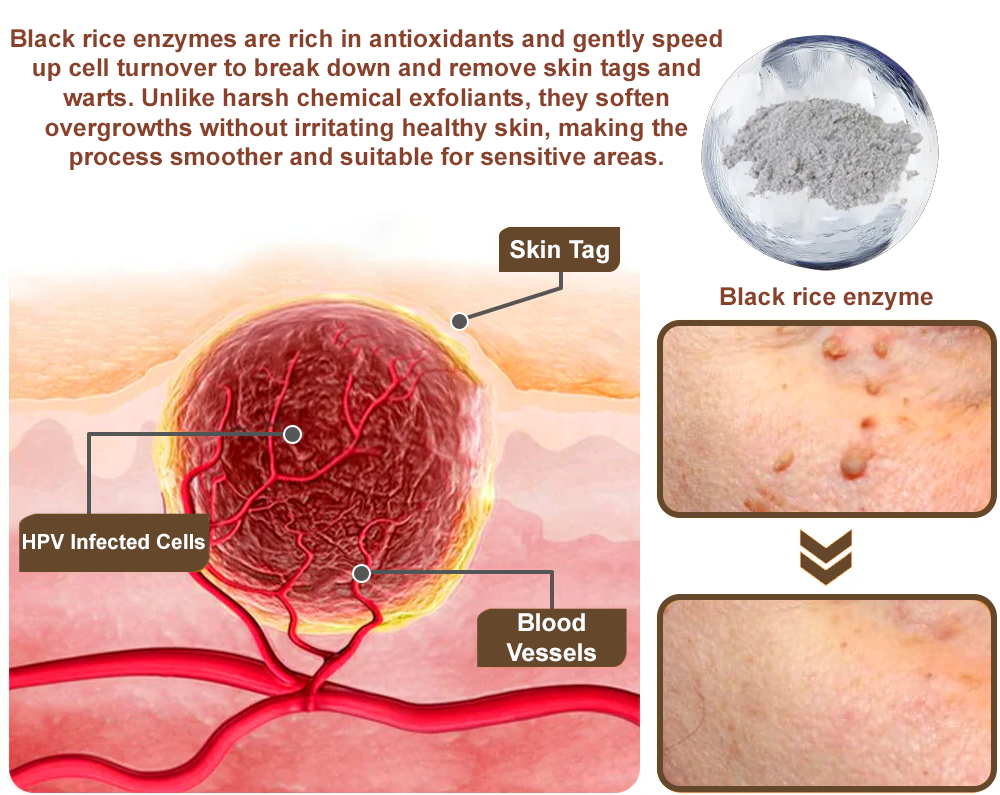 Natravor® Black Rice Skin Repair Essence Cream ⚕️ FDA Certified (Removes warts and skin growths, improves keratin buildup and seborrheic dermatitis, follicular keratosis, age spots, and bruising)