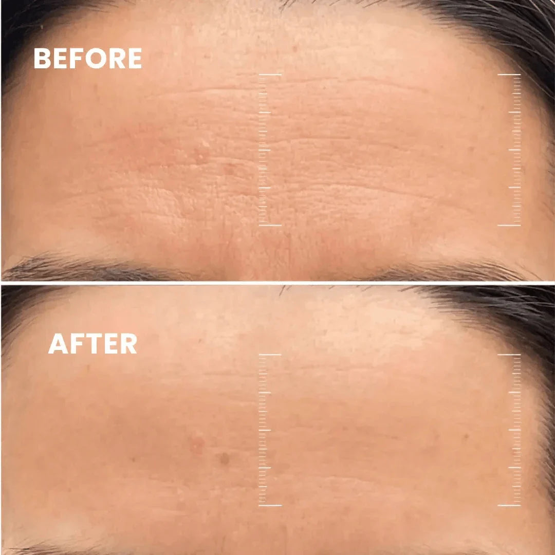 Lumiéra Mask Collagen-Boosting Night Mask | Visibly younger skin in just 7 days!