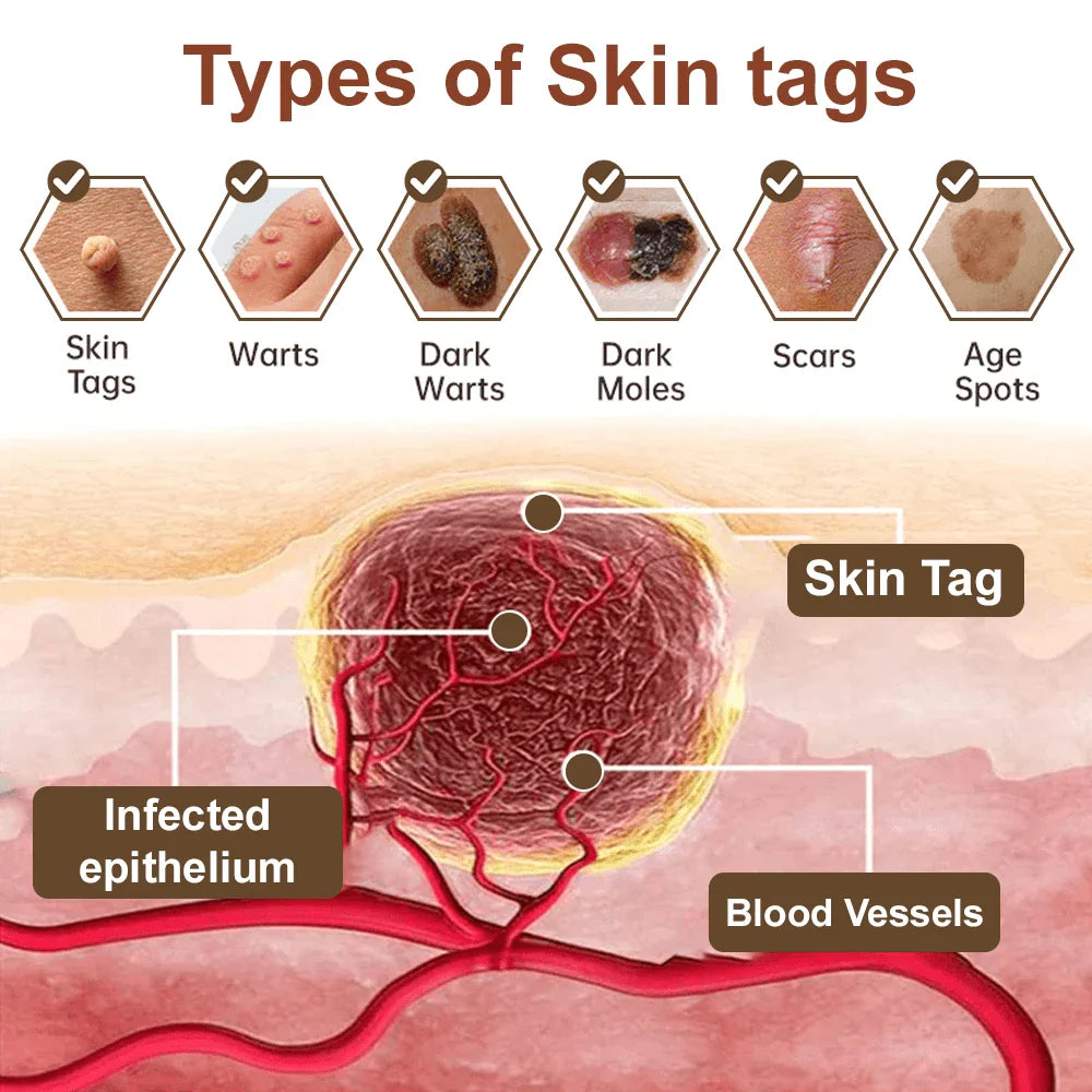 Natravor® Black Rice Skin Repair Essence Cream ⚕️ FDA Certified (Removes warts and skin growths, improves keratin buildup and seborrheic dermatitis, follicular keratosis, age spots, and bruising)