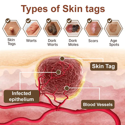 Natravor® Black Rice Skin Repair Essence Cream ⚕️ FDA Certified (Removes warts and skin growths, improves keratin buildup and seborrheic dermatitis, follicular keratosis, age spots, and bruising)